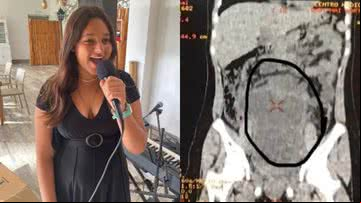 Ruby-Mae e a radiografia de seu tumor de 3,6 quilos - Arquivo Pessoal
