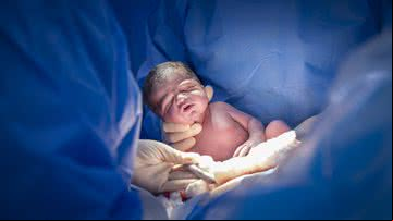 Imagem ilustrativa do nascimento de um bebê - Getty Images