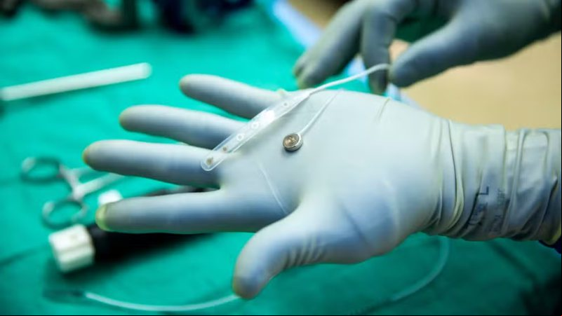Connexus, novo chip cerebral da empresa americana Paradromics - Divulgação/Paradromics