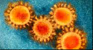 Imagem do Coronavírus em microscópio - Divulgação